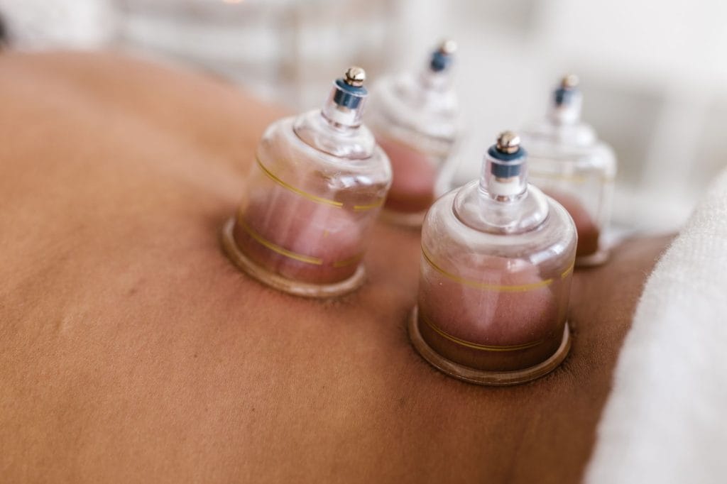 close up shot of a cupping therapy
